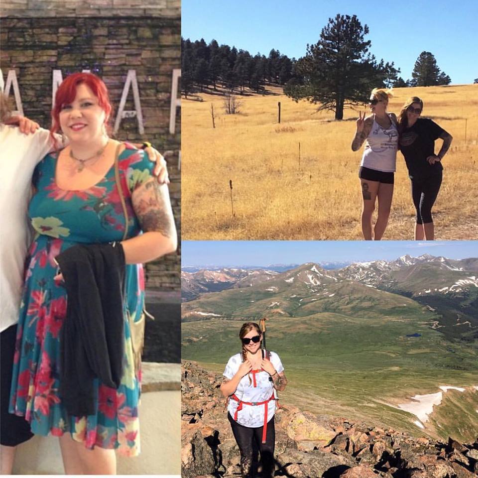 Before and After weight loss surgery - Mountain hike