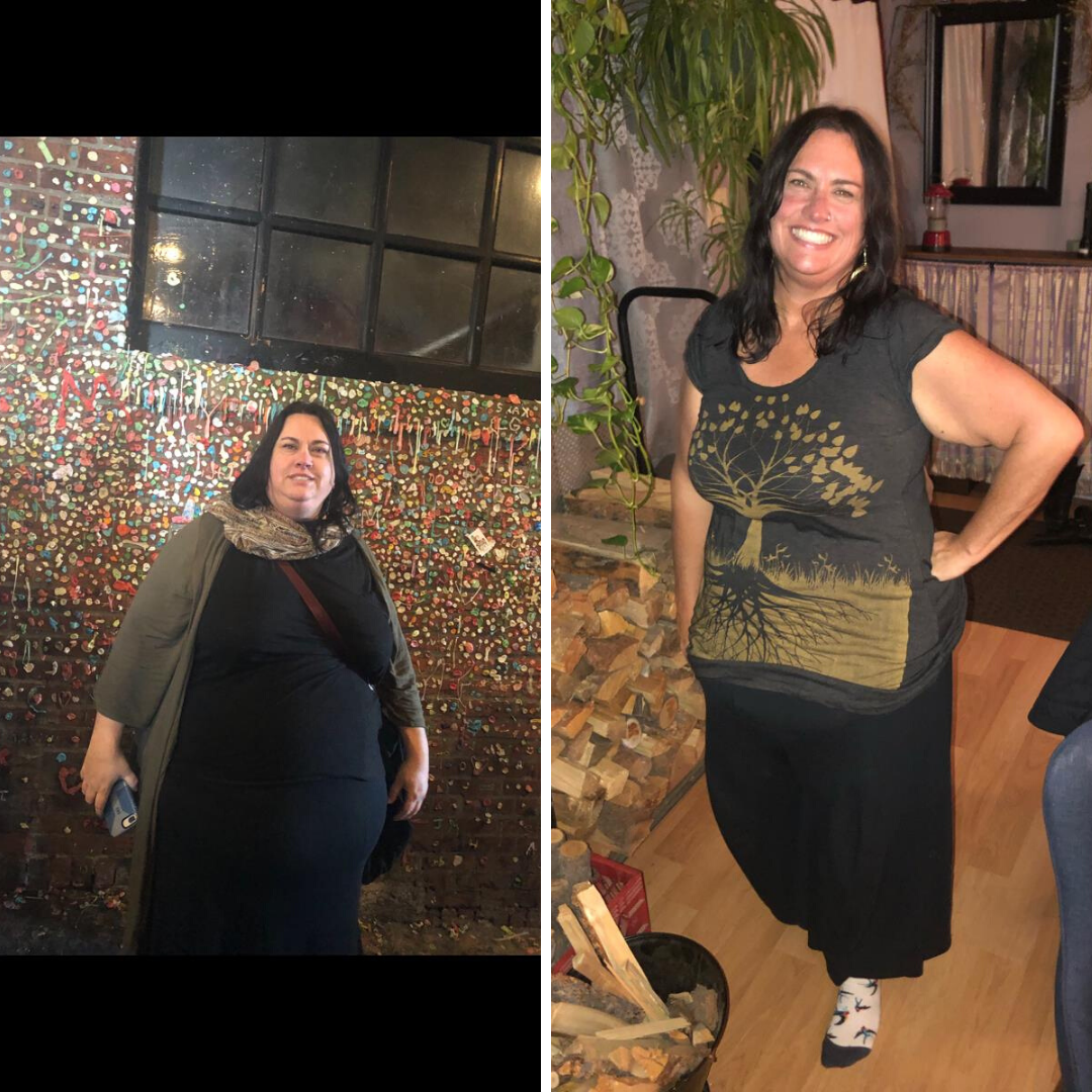 Before and after bariatric surgery - standing against wall & smiling outside